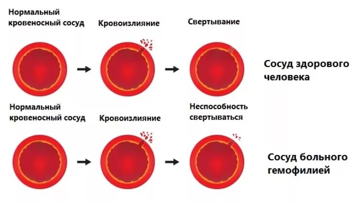 Ярко красный цвет крови является признаком