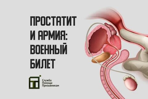 Конкремент предстательной