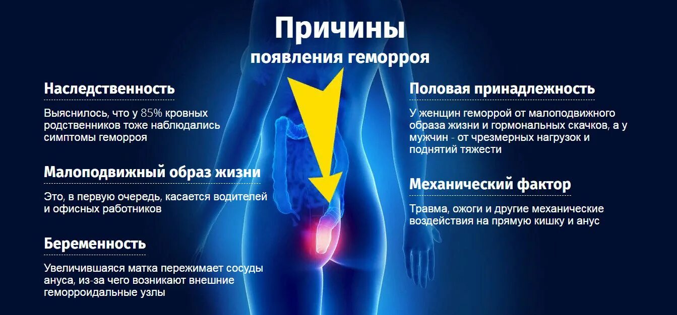 Геморрой причины возникновения. Предпосылки возникновения геморроя. Лечение внутреннего геморроя в домашних условиях