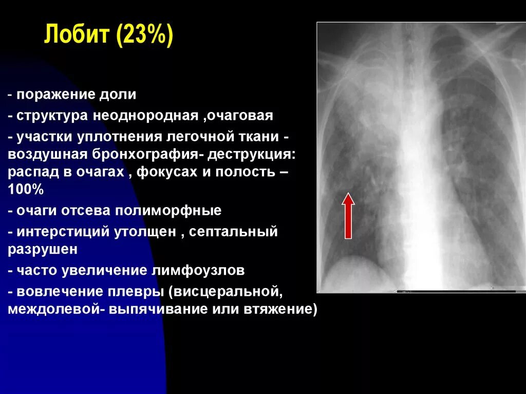 Лобить