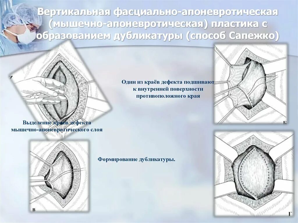 Пластика мостовидным лоскутом метод склифосовского. Пластика по размеру. Мостовидный пластика кожи. Пластика по размеру. Мостовидный пластика кожи.