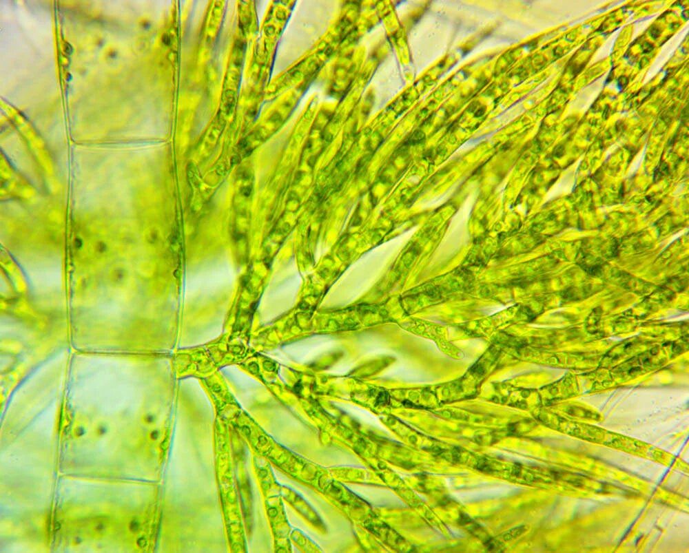 Низшие зеленые водоросли. Харовые водоросли Хара. Нителла водоросль. Кладофора водоросль микроскоп. Драпарнальдия водоросль Байкала.