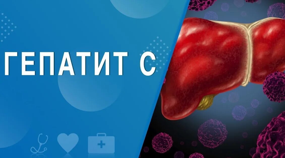 Гепатит с 5. Вирусные гепатиты. гепатит с излечим.