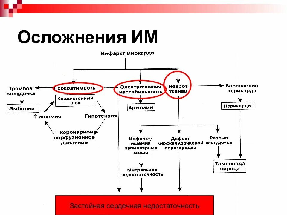Как получить инфаркт. Инфаркт миокарда клиника симптомы. причины инфаркта миокарда схема. осложнения инфаркта миокарда классификация. патогенез осложнений инфаркта миокарда.