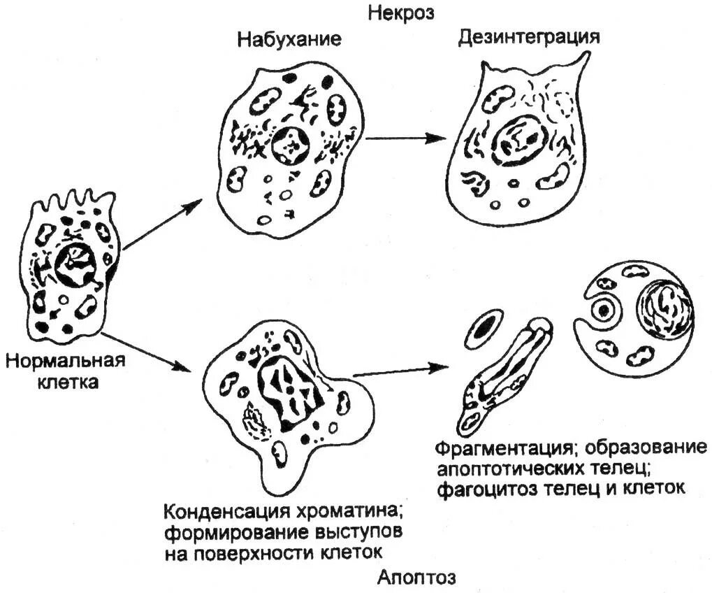 Некроз клетки схема. Последовательно этапы морфогенеза некроза. Схема некроз патология. Механизм некроза схема.