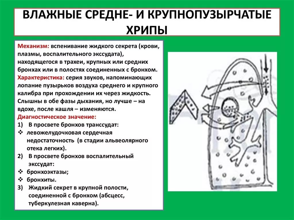 Влажные среднепузырчатые хрипы. Средне и крупнопузырчатые хрипы. Влажные хрипы характерны для. Медлкопузырчатые хрипы.