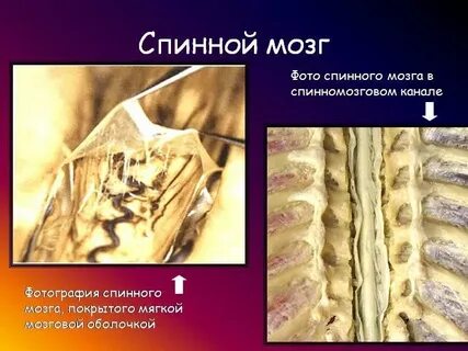Спинномозговой канал это