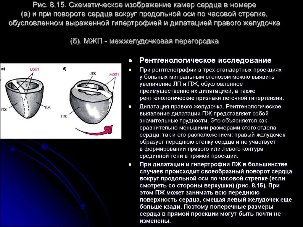 Поворот сердца правым желудочком вперед. Поворот сердца левым желудочком вперед. Поворот сердца вокруг продольной оси. Поворот сердца правым желудочком. Поворот правым желудочком вперед