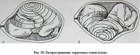Рис 29