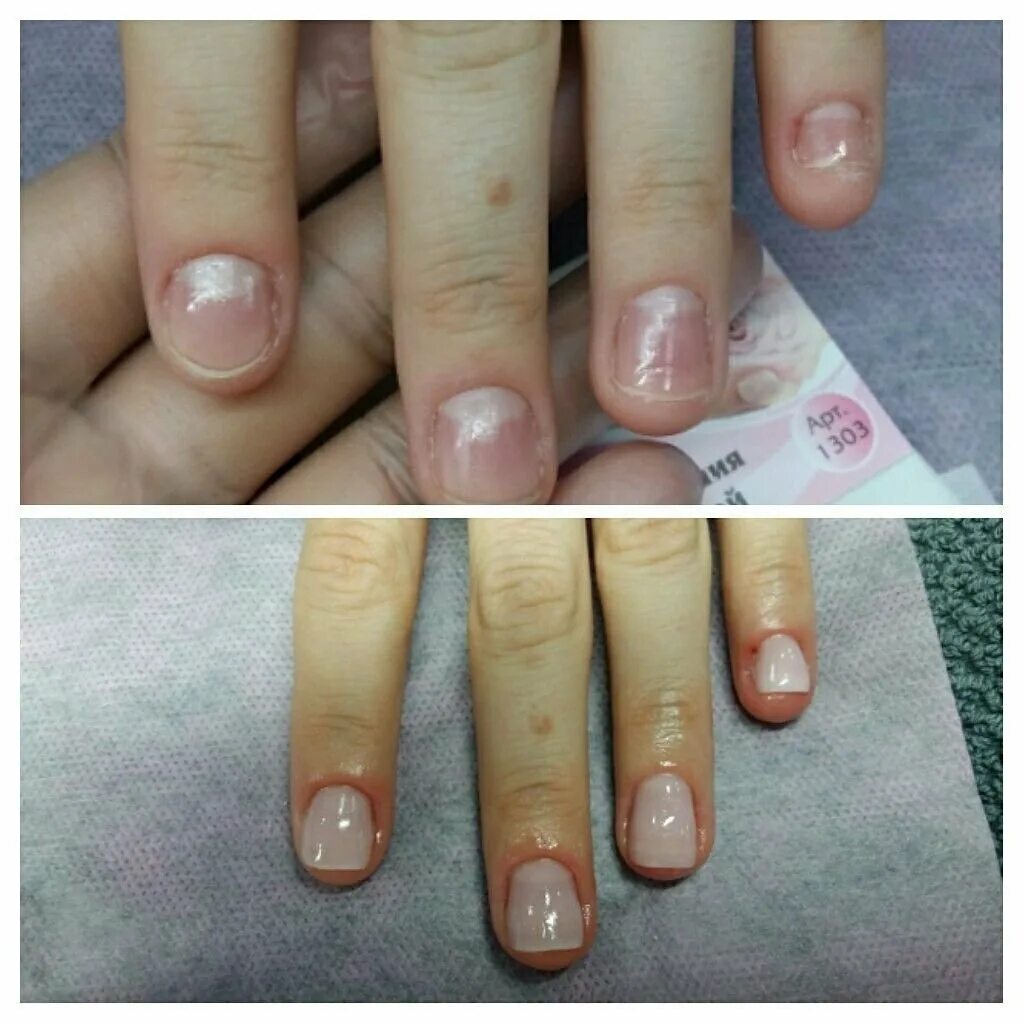 наращивание обкусанных ногтей. нарощенные ногти на обгрызанные ногти. наращивание ногтей до и после. наращивание ногтей на обгрызанные ногти. маникюр на короткие обгрызанные ногти.