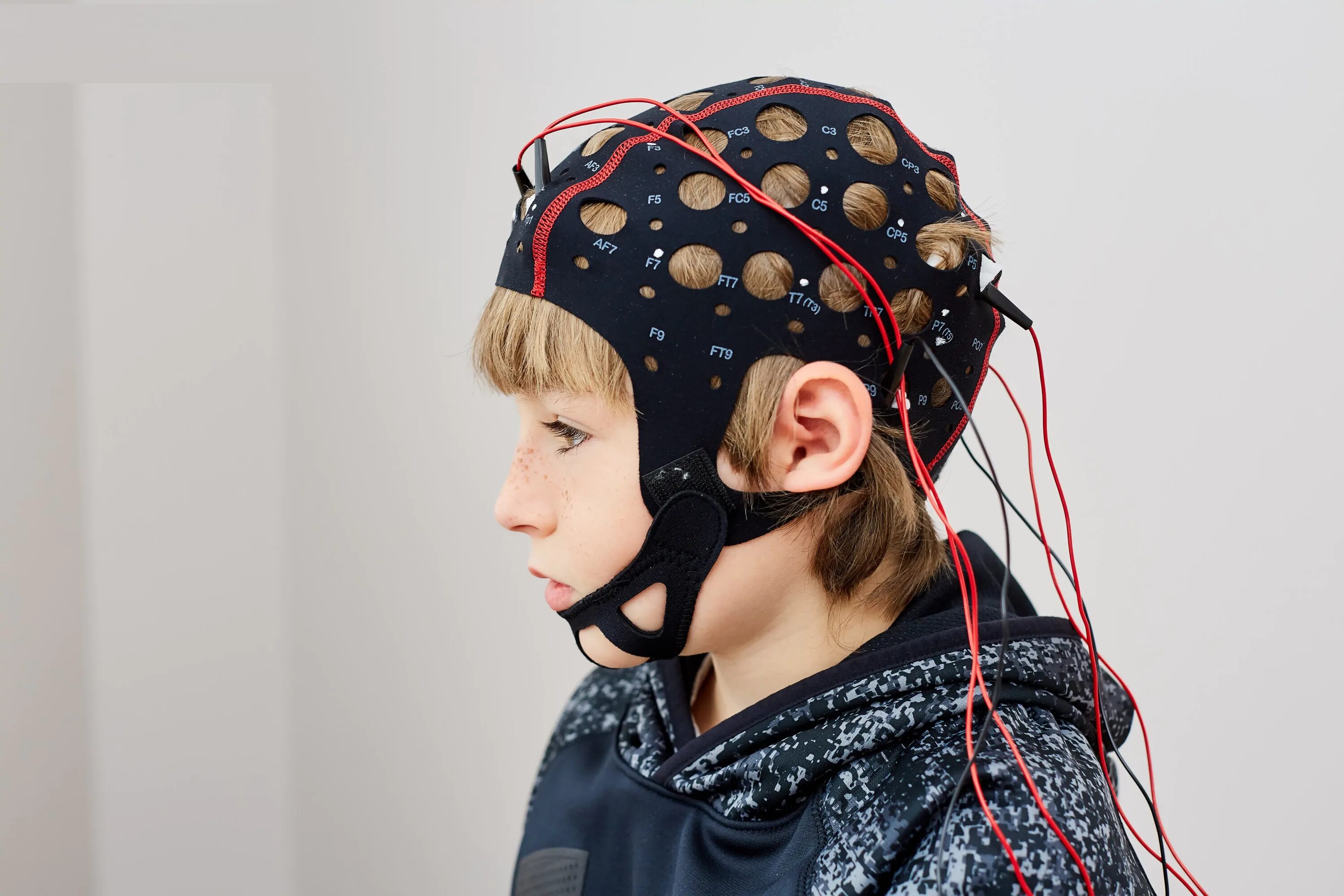 Аппарат транскраниальной магнитной стимуляции. Микрополяризация полярис. Микрополяризация головного мозга магнон. Ран мозга имени н. Транскраниальная микрополяризация (ткмп).