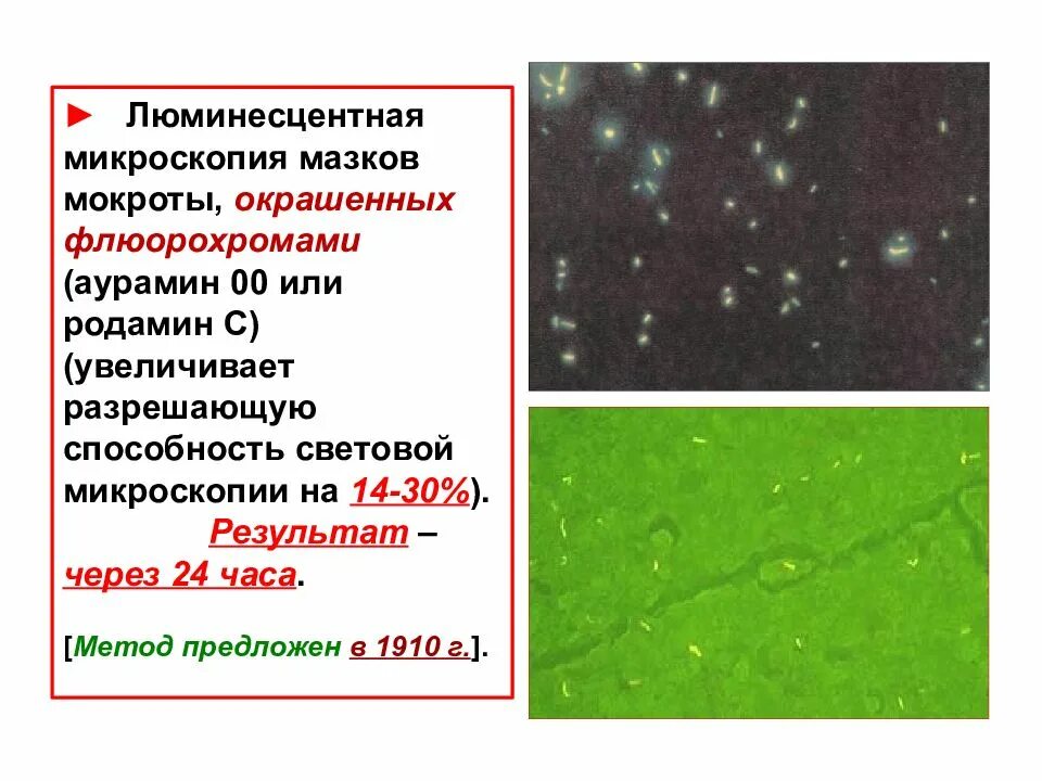 Микобактерии люминесцентная микроскопия. Люминесцентная микроскопия микробиология. Микобактерии туберкулеза люминесцентная микроскопия. Люминесцентная микроскопия туберкулеза. Анализ мокроты на микобактерии