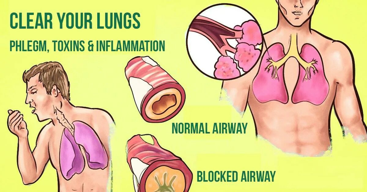 Слизь в лёгких и бронхах. Что делают легкие при кашле