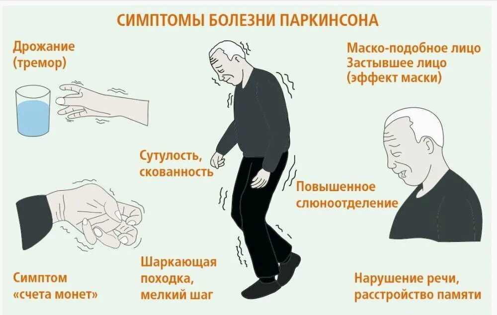 Непроизвольное подергивание рукой