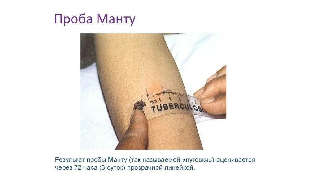 Через сколько можно мочить