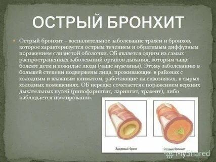 Трахеобронхит симптомы у детей