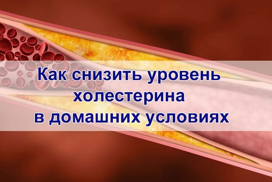 Снизить уровень холестерина. Холестерин терапия. Способы понижения холестерина. Холестерин в крови.