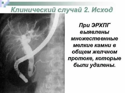 Случай исход
