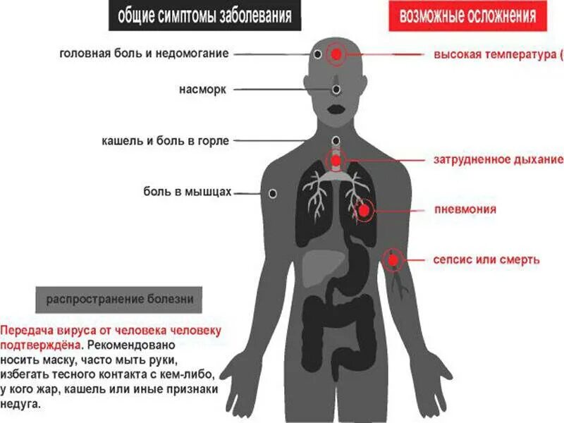 Осложнения коронавирусной инфекции. Признаки коронавируса. Признаки коронавируса у человека симптомы первые. Признаки короноваоису. Признаки клрооовирусп.