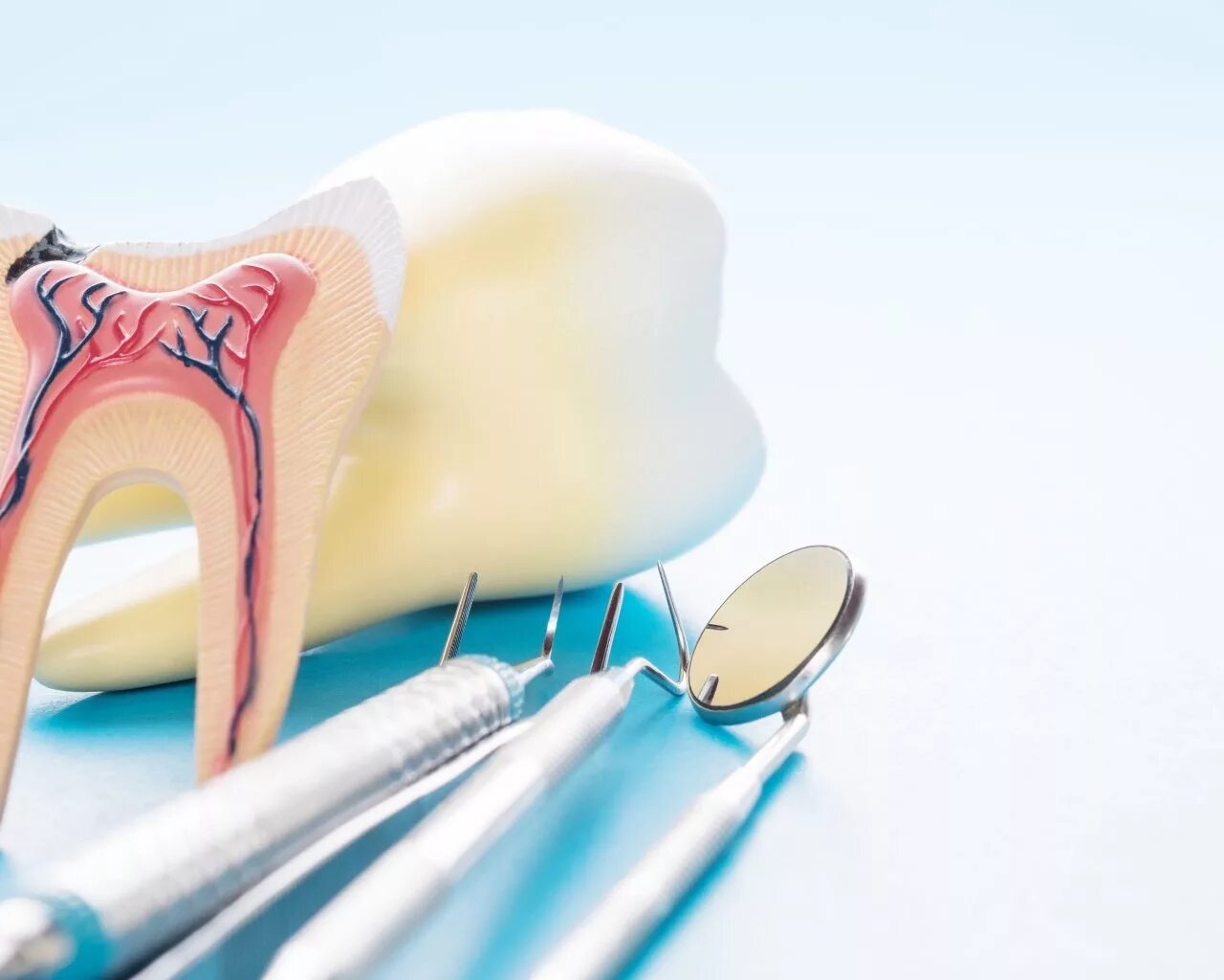 Отзывы после лечения зубов. 4 Канальный пульпит зуба. Пульпита (депульпирование зуба.