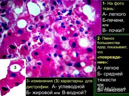 Лизис функции