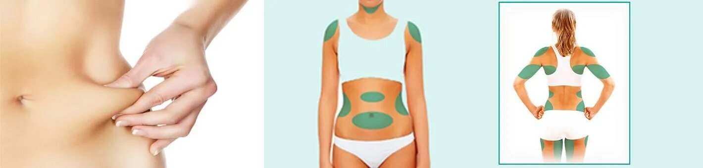 Проблемные зоны тела. Проблемные зоны женской фигуры. Проблемные зоны тела у женщин. Схема введения липолитиков в живот. Женский живот.