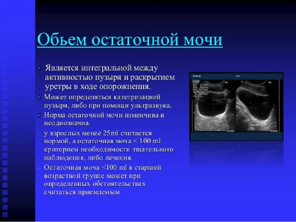 Размер мочевого пузыря у мужчин. УЗИ мочевого пузыря норма. Норма объема остаточной мочи в мочевом пузыре у женщин. Объем мочевого пузыря на УЗИ норма. УЗИ С измерением остаточной мочи мочевого пузыря.