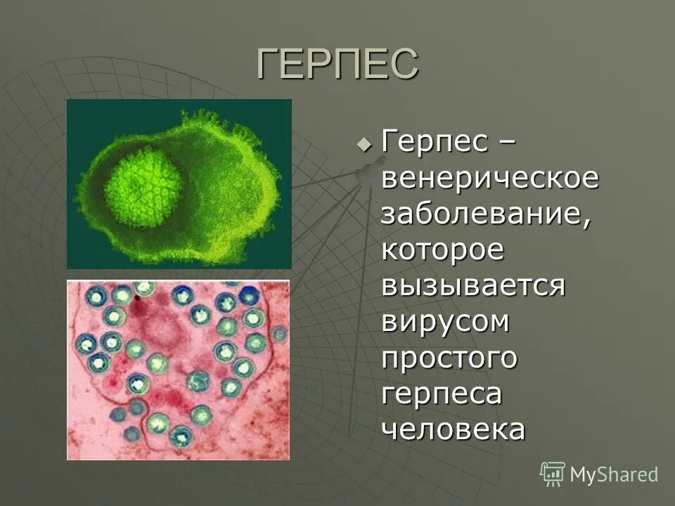 Вирусные заболевания герпес. Генитальный герпес этиология. Вирусные заболевания половым путем