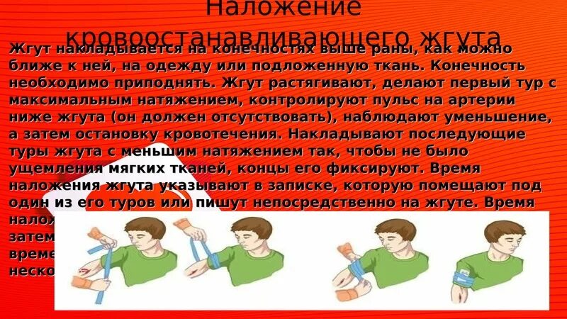 Кровоостанавливающий жгут накладывается выше раны на:. Наложение кровоостанавливающего жгута на одежду. Кровоостанавливающий жгут накоадывается выше раеы н.