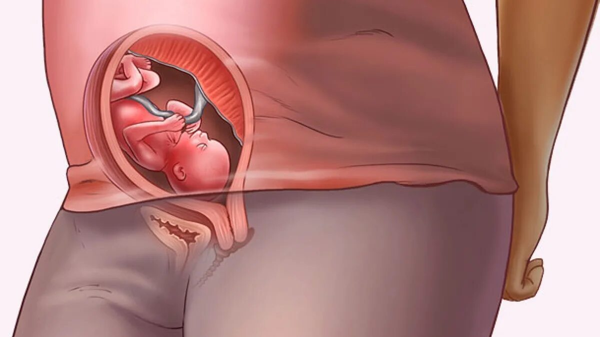 Живот на 19 неделе беременности. 19 Недель беременности фото плода в животе. Ребёнок в 19 недель беременности. Расположение плода на 19 неделе беременности. 19 недель тянет живот