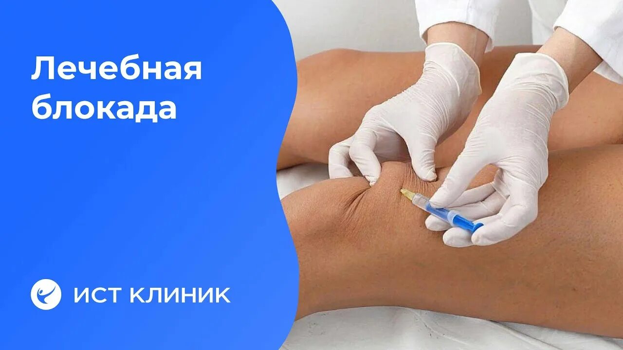 Лечим боли блокадами! Блокада спасет вас от болей в области позвоночника, сустав