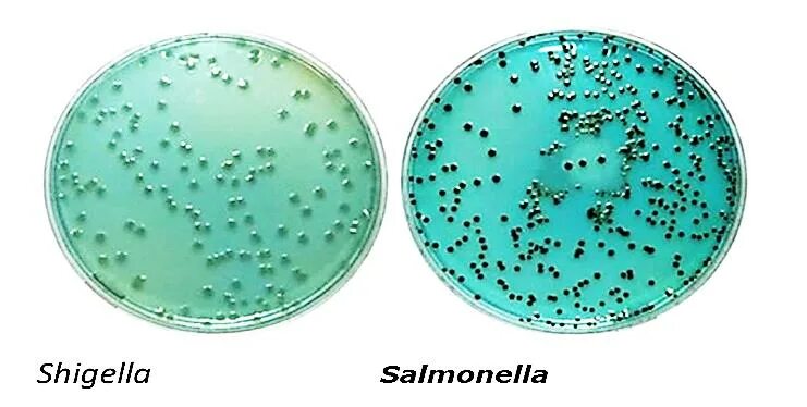 Spp salmonella spp shigella spp. Шигелла sonnei. шигелла дизентерия микробиология. бактерии шигеллы. бактерия shigella.