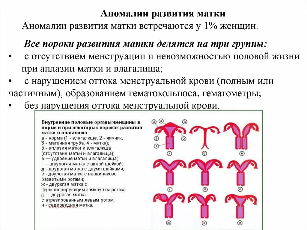 Классификация аномалий развития женских половых органов. Развитие матки маточных труб аномалии развития. Аномалии развития женских половых органов анатомия. Аномалии развития матки клинические рекомендации.