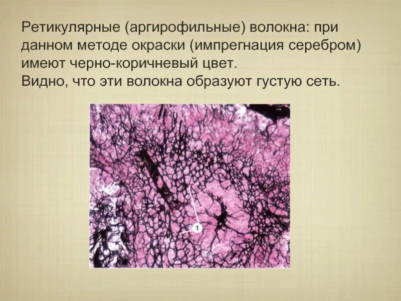 Ретикулярные волокна. Ретикулярные волокна. Ретикулярная соединительная ткань гистология. Ретикулярные волокна строение. Ретикулярные волокна.