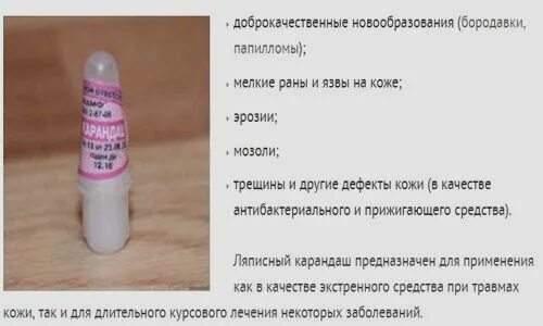 Ляписный карандаш инструкция по применению от бородавок. Прижигание бородавок ляписным карандашом. ляпис карандаш от бородавок. папиллому ляписным карандашом. карандаш для выведения бородавок и папиллом.