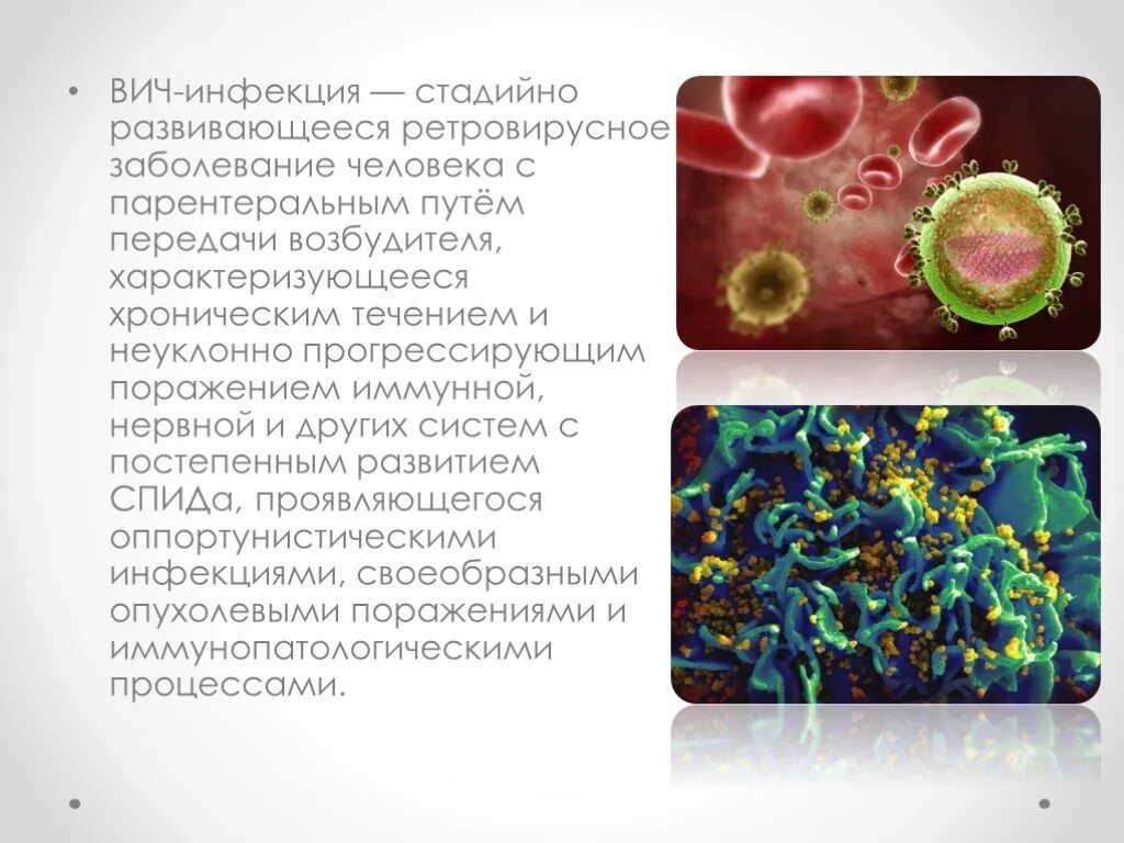 Развитие вич инфекции. Развитие ВИЧ. Инфекция иммунной системы /СПИД/. Вирус иммунодефицита человека возбудитель. Возбудитель ВИЧ инфекции.