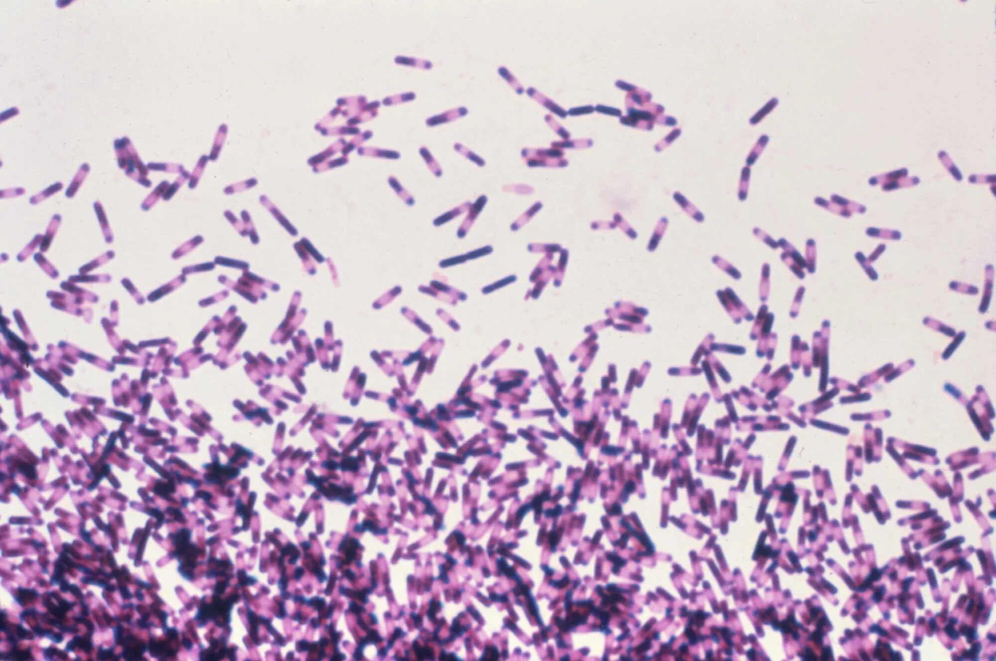 Clostridium spp. Грамположительные бациллы. Клостридии.. Клостридии ботулизма микроскопия. Clostridium botulinum микроскоп.