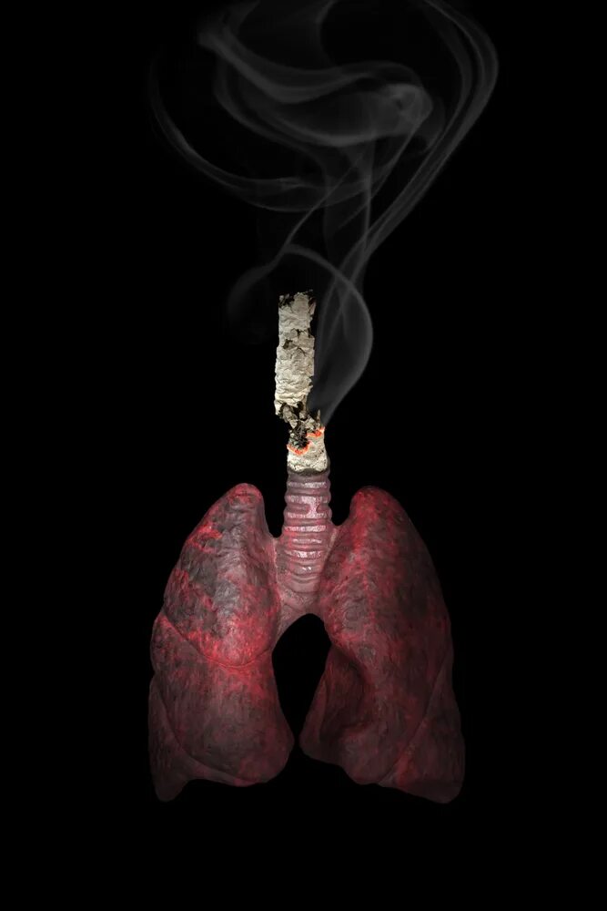 Как выглядят легкие сигареты. Сигареты винстон икстайл синий. Легкие курильщика изнутри. Мальборо ментол gold. Лёгкие сигареты.