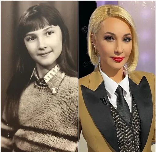 Символично": Лера Кудрявцева показала, как выглядит после операции просто