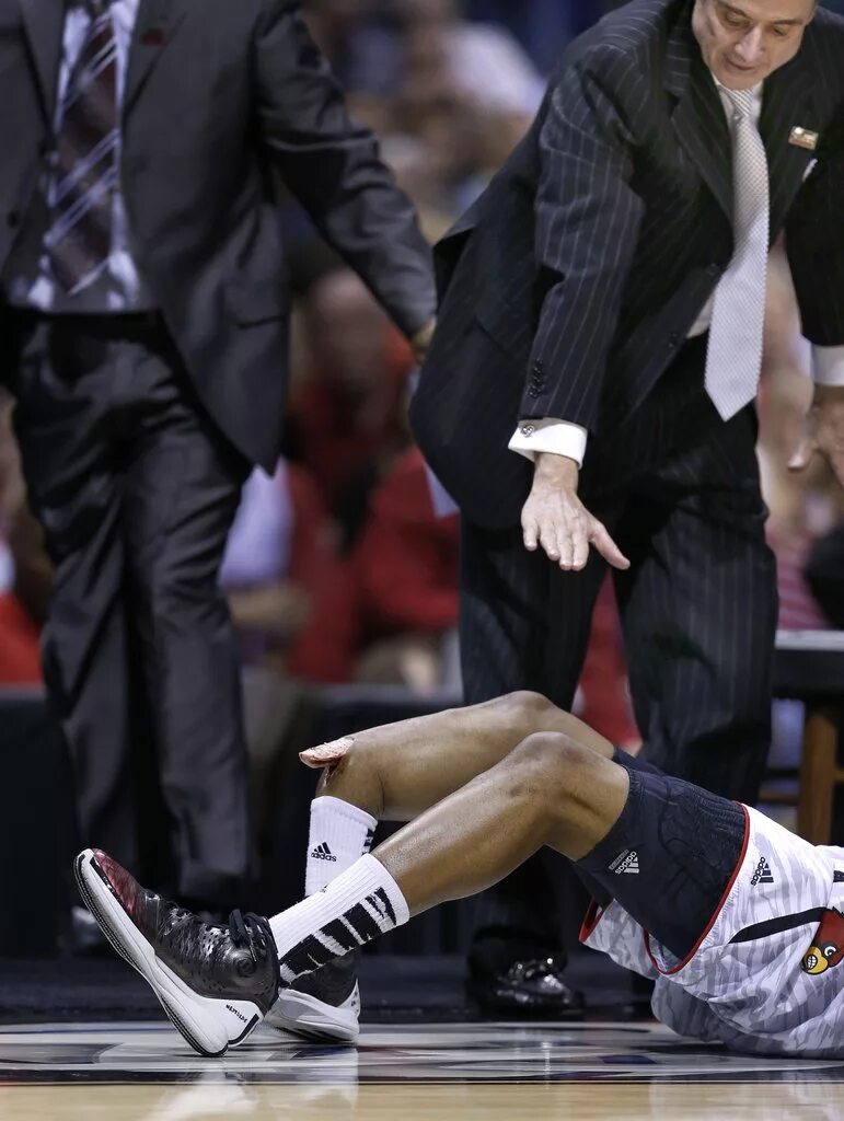 Резкий крутой перелом в чем нибудь. Кевин Уэйр баскетболист. Кевин Уэйр баскетболист травма.
