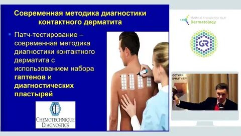 Контактный тест
