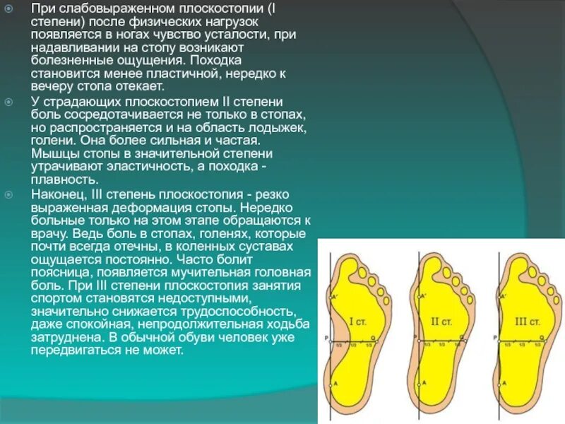 Поступь стали 8. Плоскостопие 1, 2, 3 степени. Степени плоскостопия в градусах. Плоскостопие по степеням. Первая степень плоскостопия.