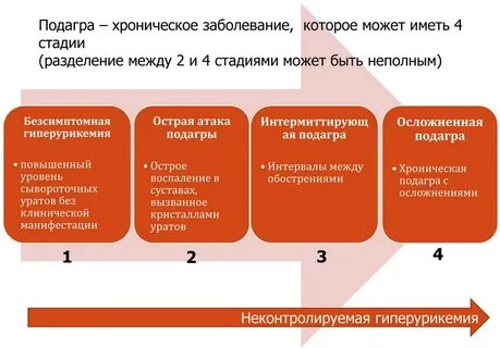 Фазы подагры