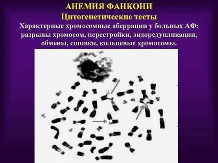 Анемия фанкони