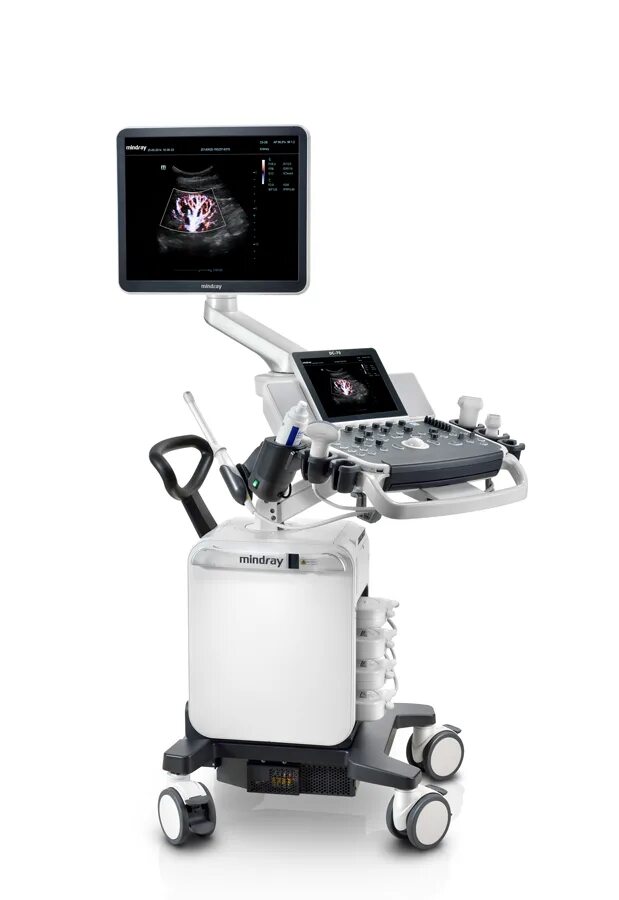 Миндрей 80. Миндрей dc 70 pro x insight. mindray dc-70 x-insight. узи сканер mindray dc-28.