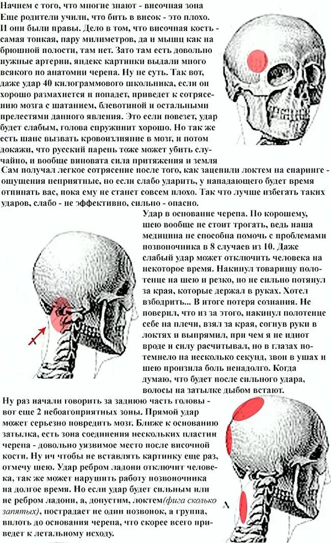 Что делать если сильно ударился. Самое слабое место в черепе. Чем можно ударить человека. Болевые точки на голове человека. Как можно омить человека?.