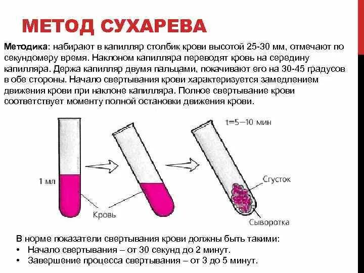 Капиллярная кровь. Время свертывания по Сухареву методика. Методы определения времени свертывания капиллярной крови. Методика определения времени свертывания и кровотечения. Методика определения времени свертывания капиллярной крови.