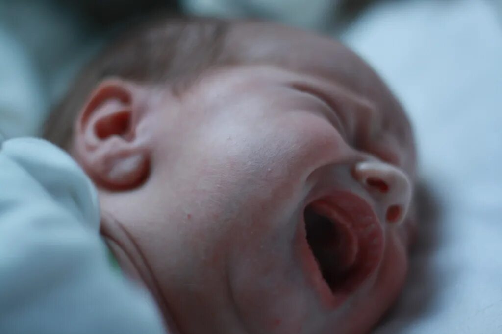 Плачь ребенка при рождении. Новорожденный плачет. Плач новорожденного ребенка. Крик новорожденного ребенка. Младенец кричит.