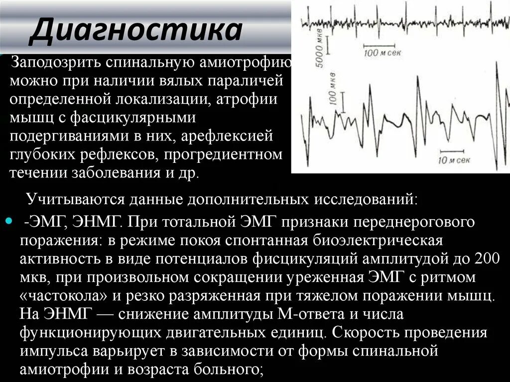 Спинальная мышечная атрофия ЭНМГ. ЭНМГ при спинальной мышечной атрофии. Спинальные амиотрофии типы. Генетическое заболевание СМА 1 типа.