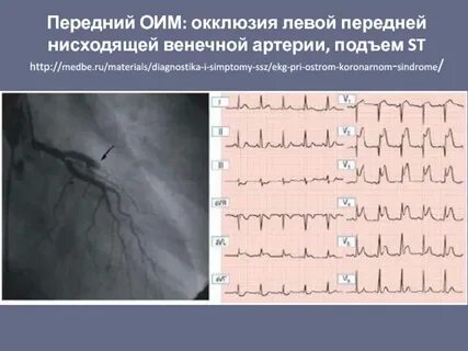 Бразг лка